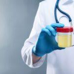 urine drug test